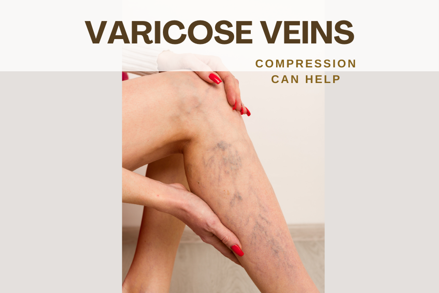 Compression for Varicose Veins