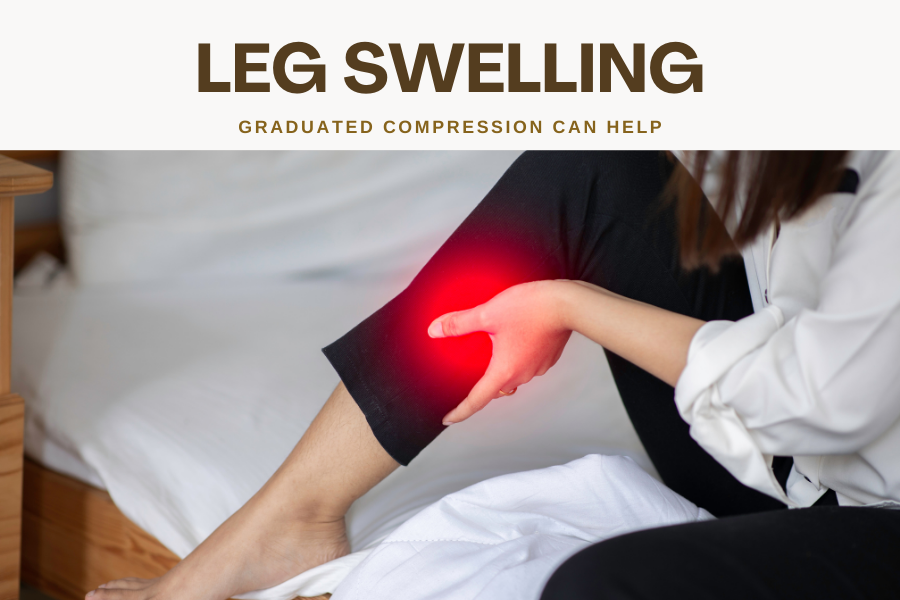 Compression for Leg Swelling